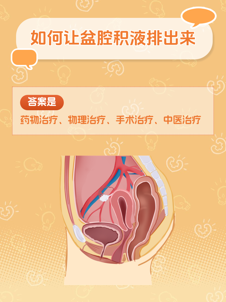 盆腔积液会导致什么
