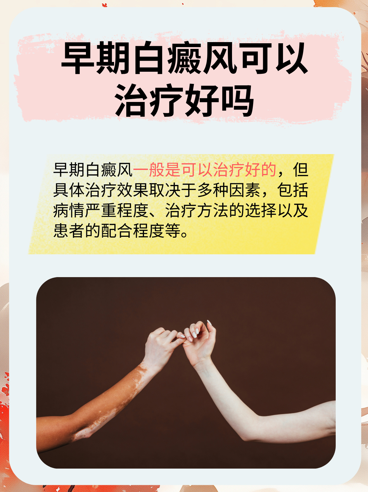 白癜风怎么治疗好得快?