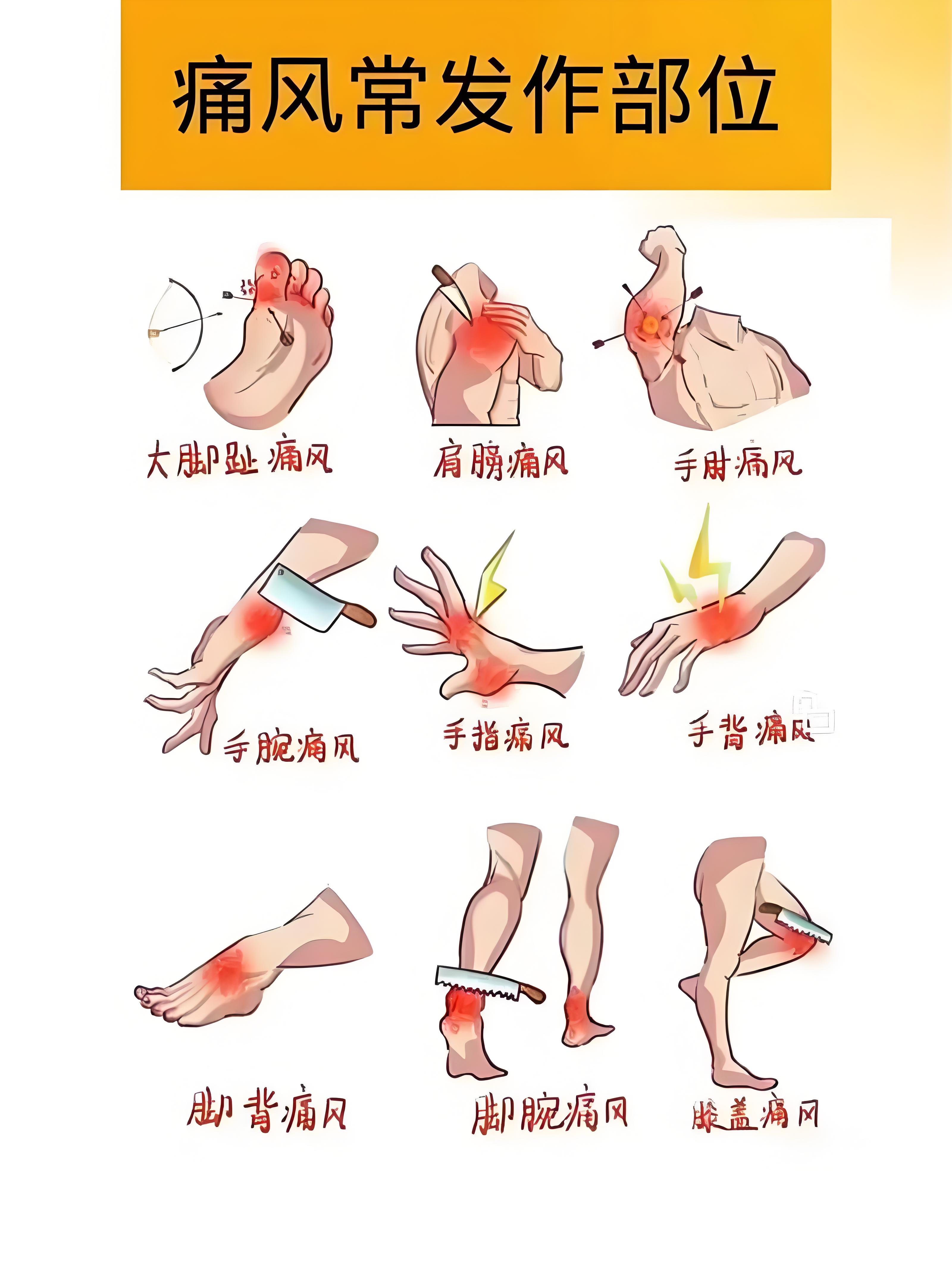 痛风怎么治疗效果好?