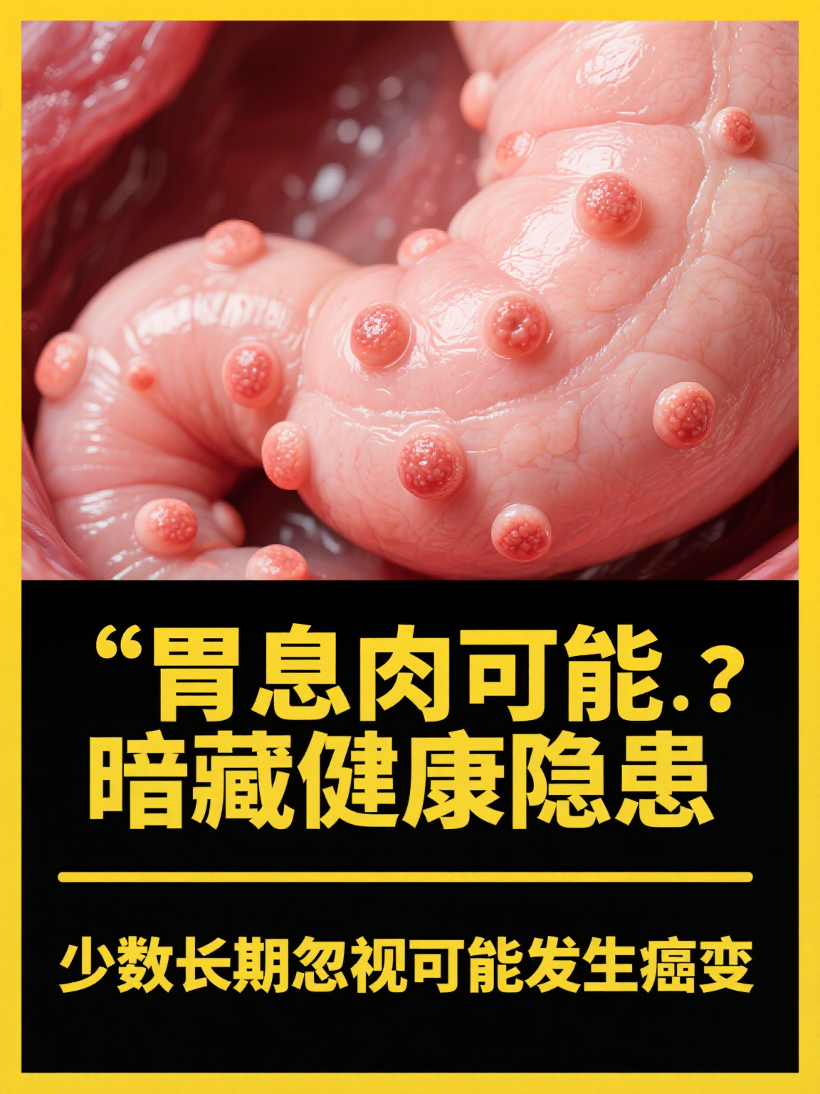 胃内长息肉严重吗