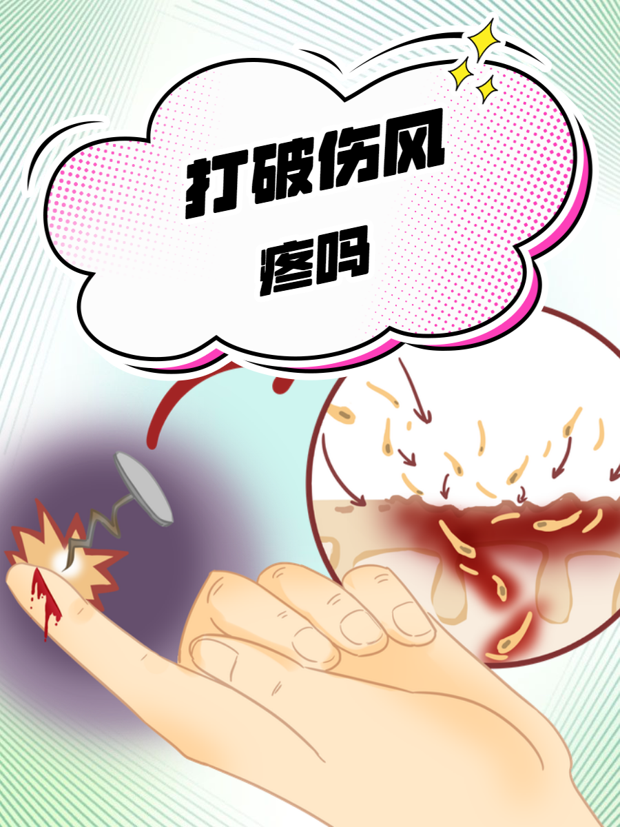 什么样的伤口需要打破伤风?