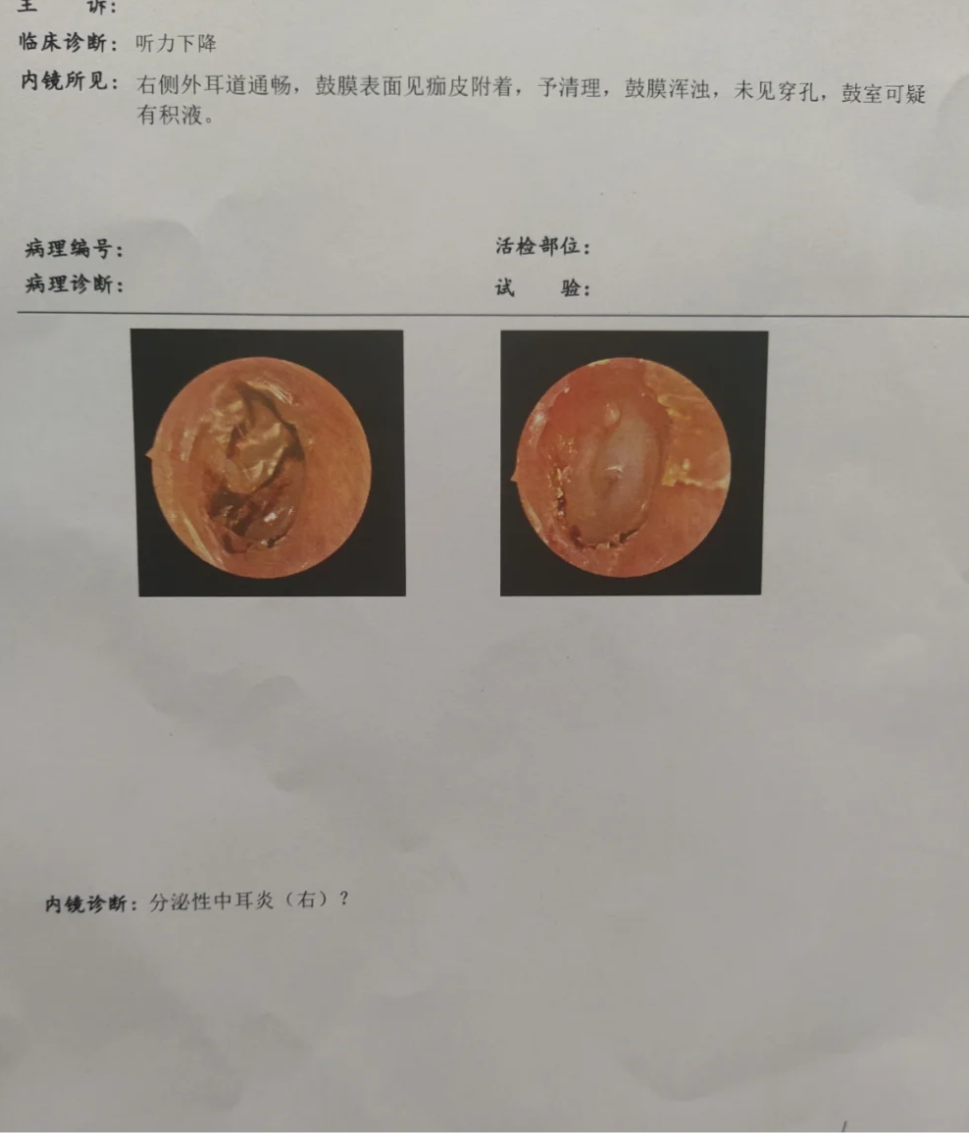 最近左耳总是耳鸣怎么回事