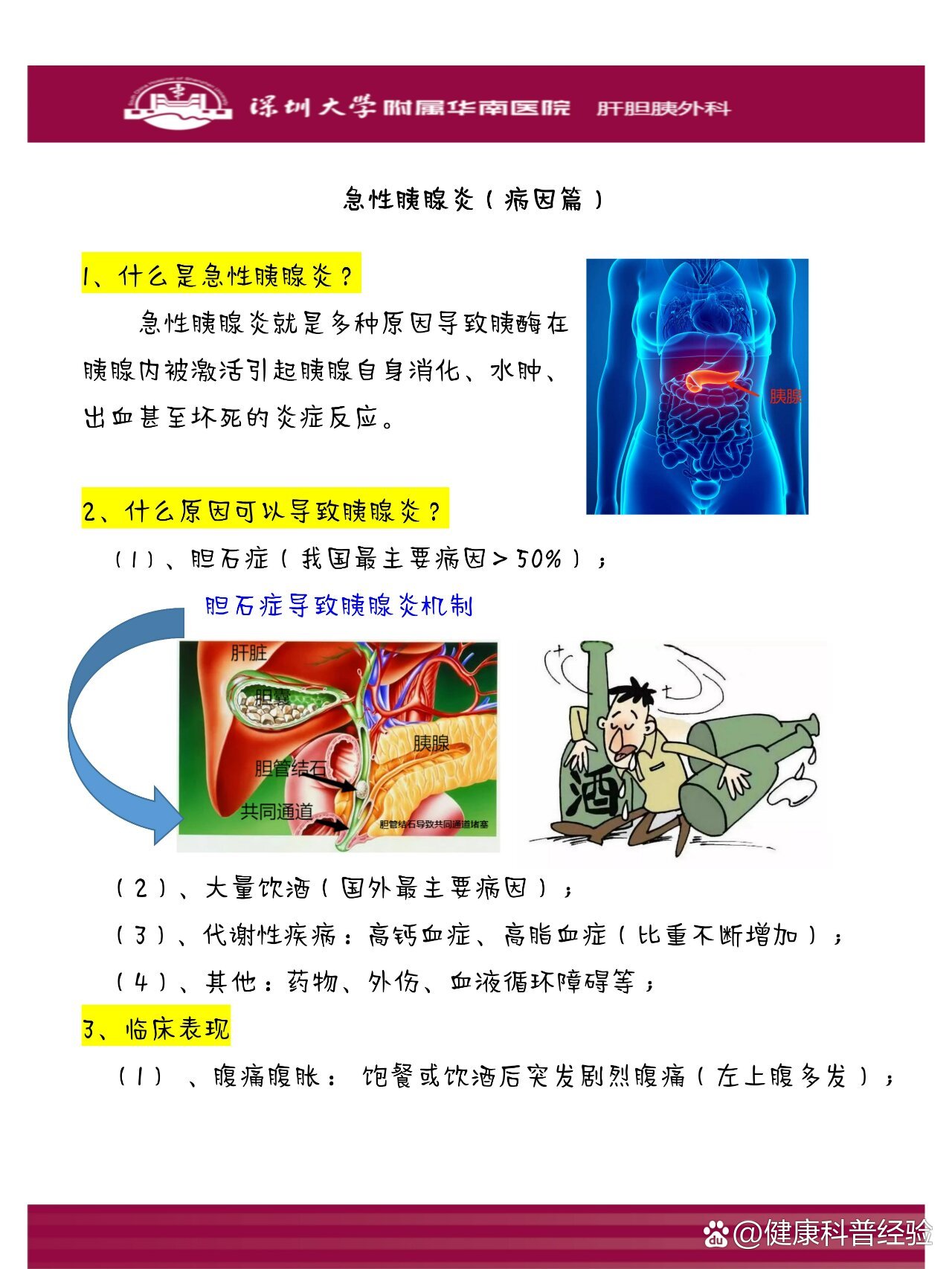 什么是重症胰腺炎?