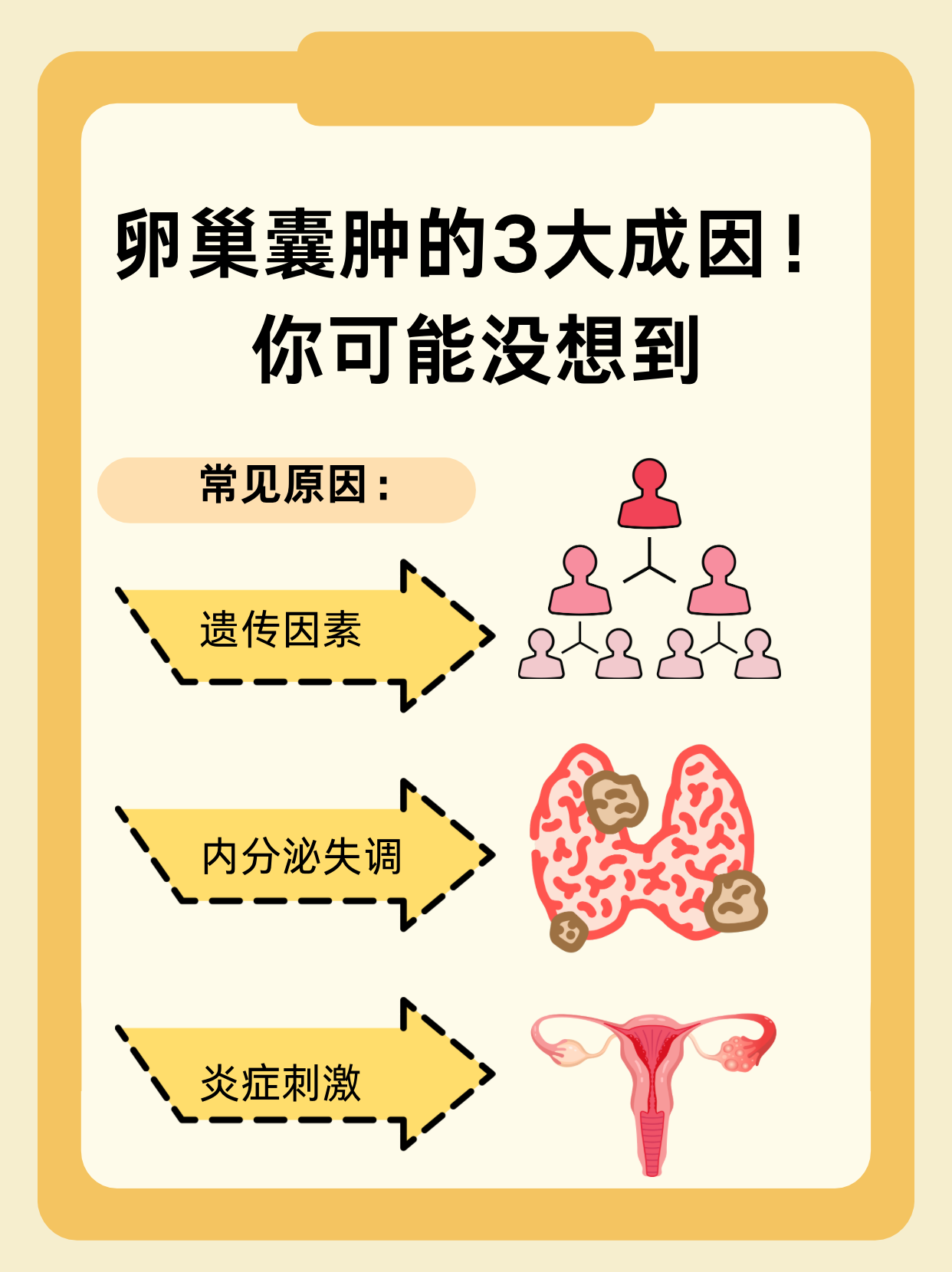 卵巢囊肿对月经有影响吗