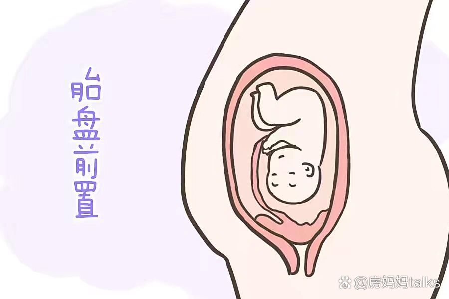 前置胎盘危险吗