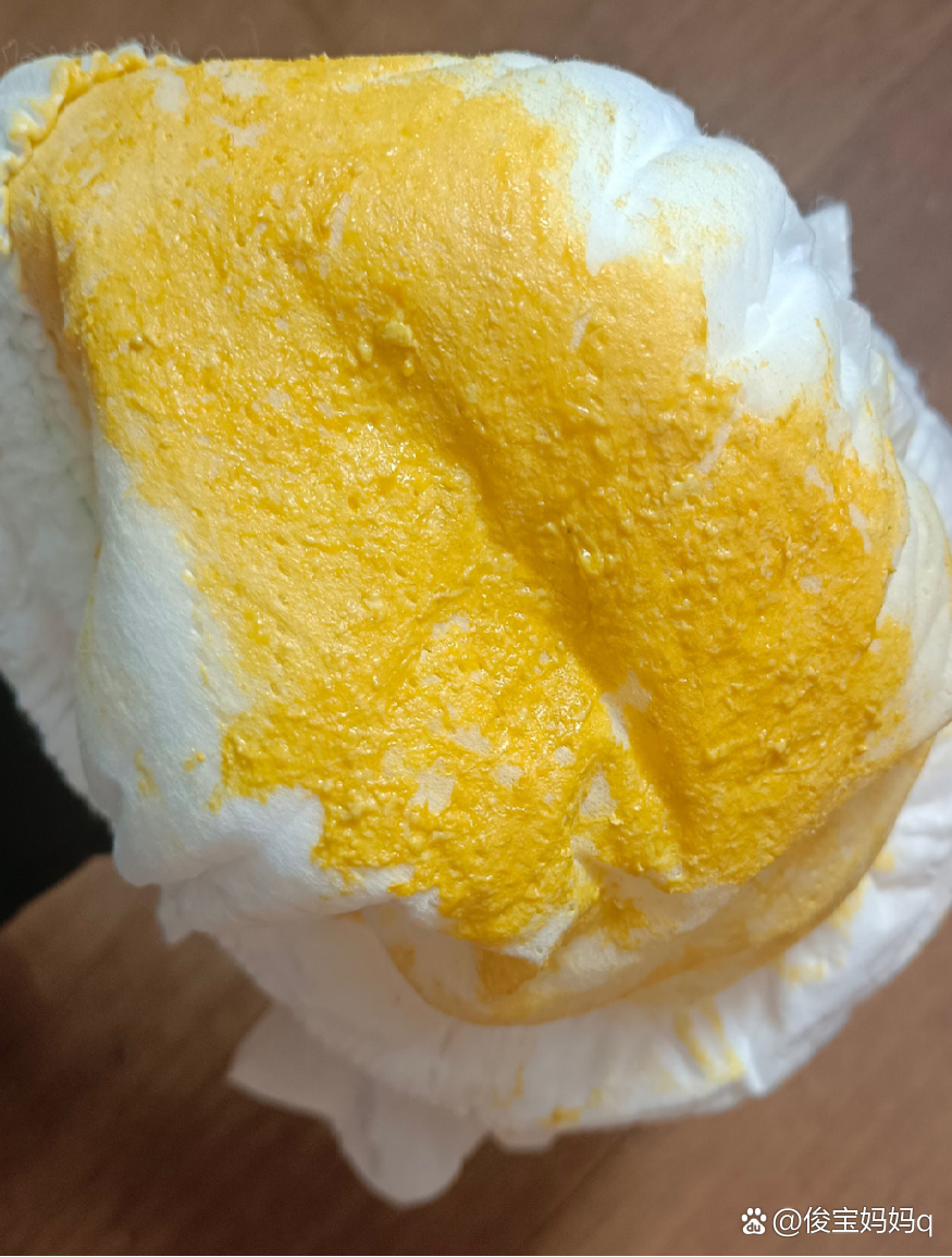 母乳喂养的宝宝拉的粑粑