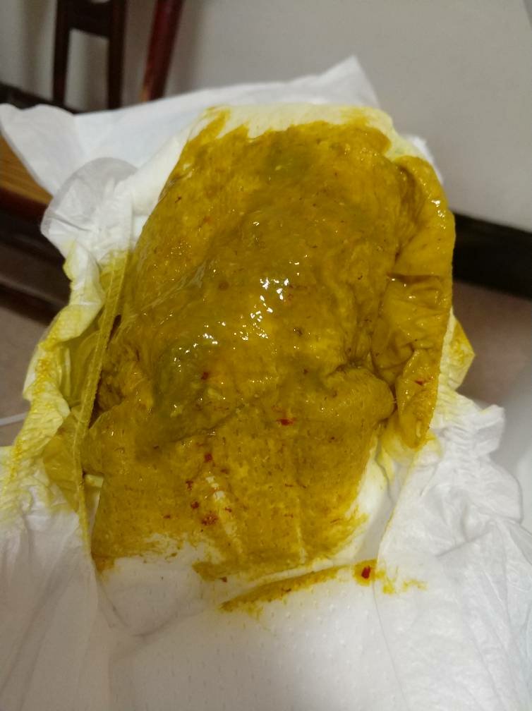 母乳喂养的宝宝拉的粑粑