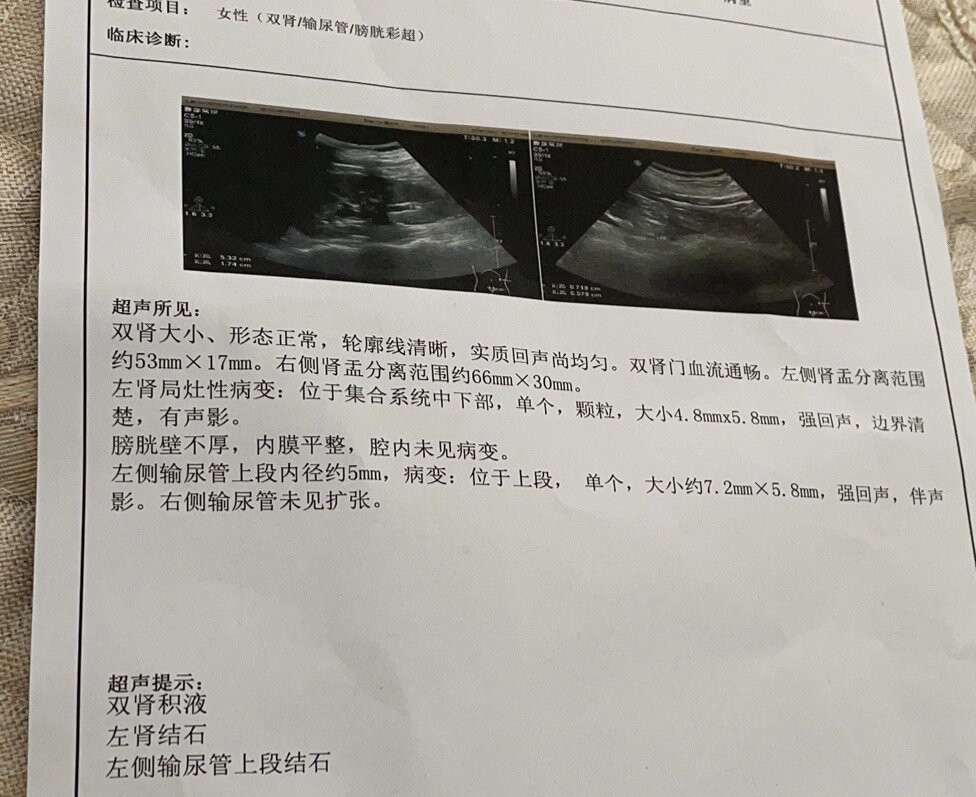 有肾结石,对怀孕有影响吗