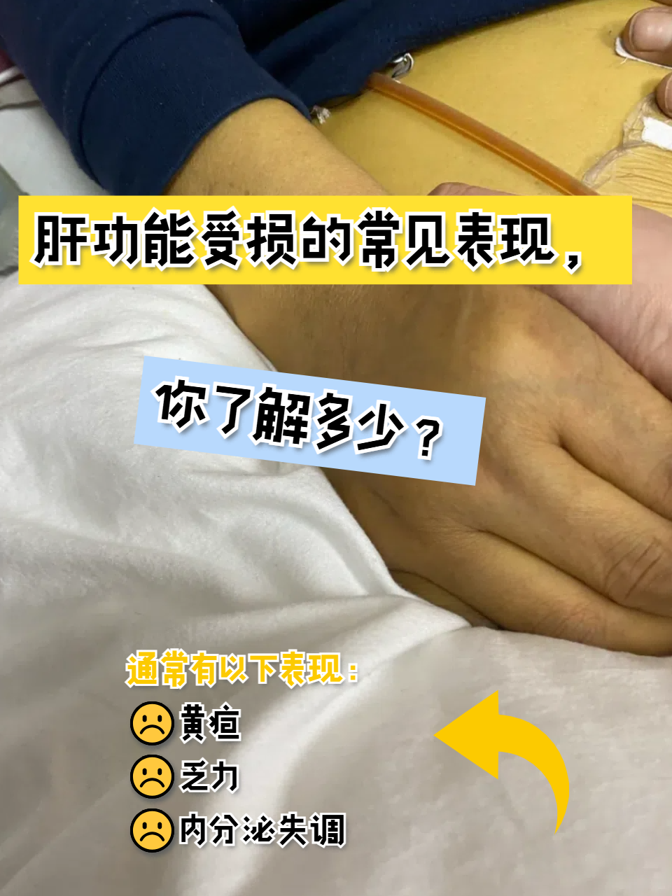 急性肝衰竭能治愈吗?