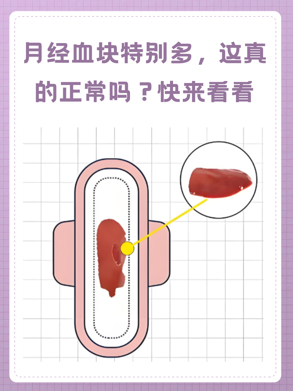 月经有血块.正常吗??