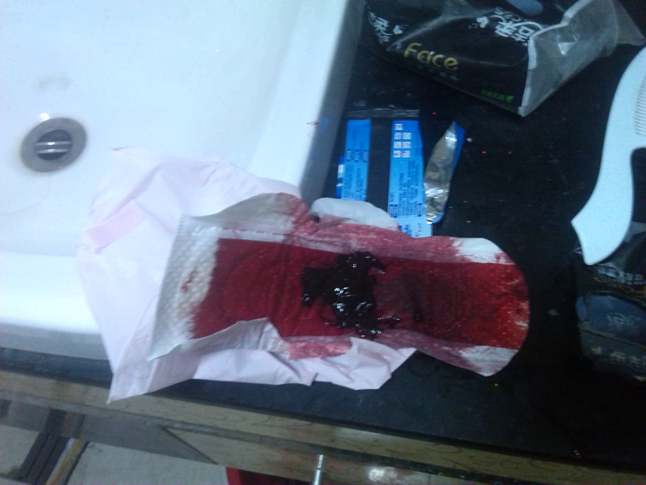 月经有血块.正常吗??