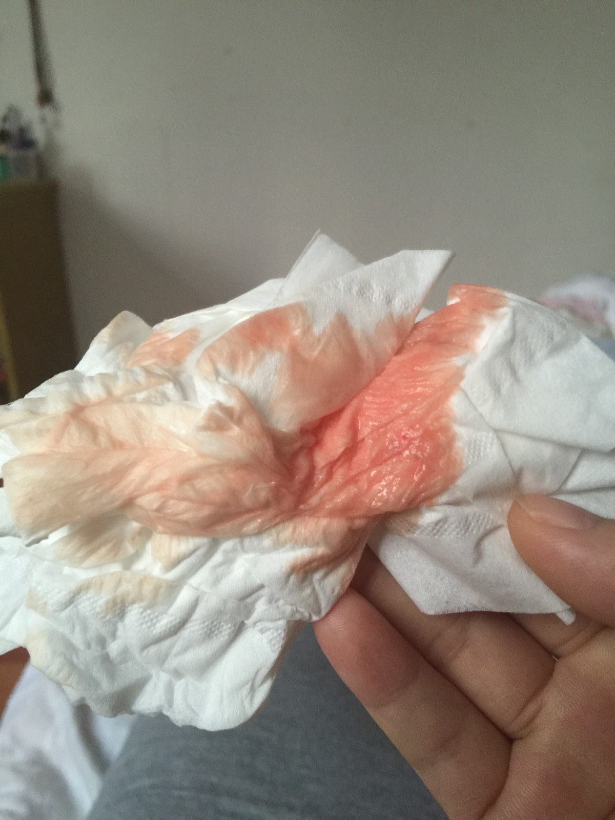 性生活之后出血