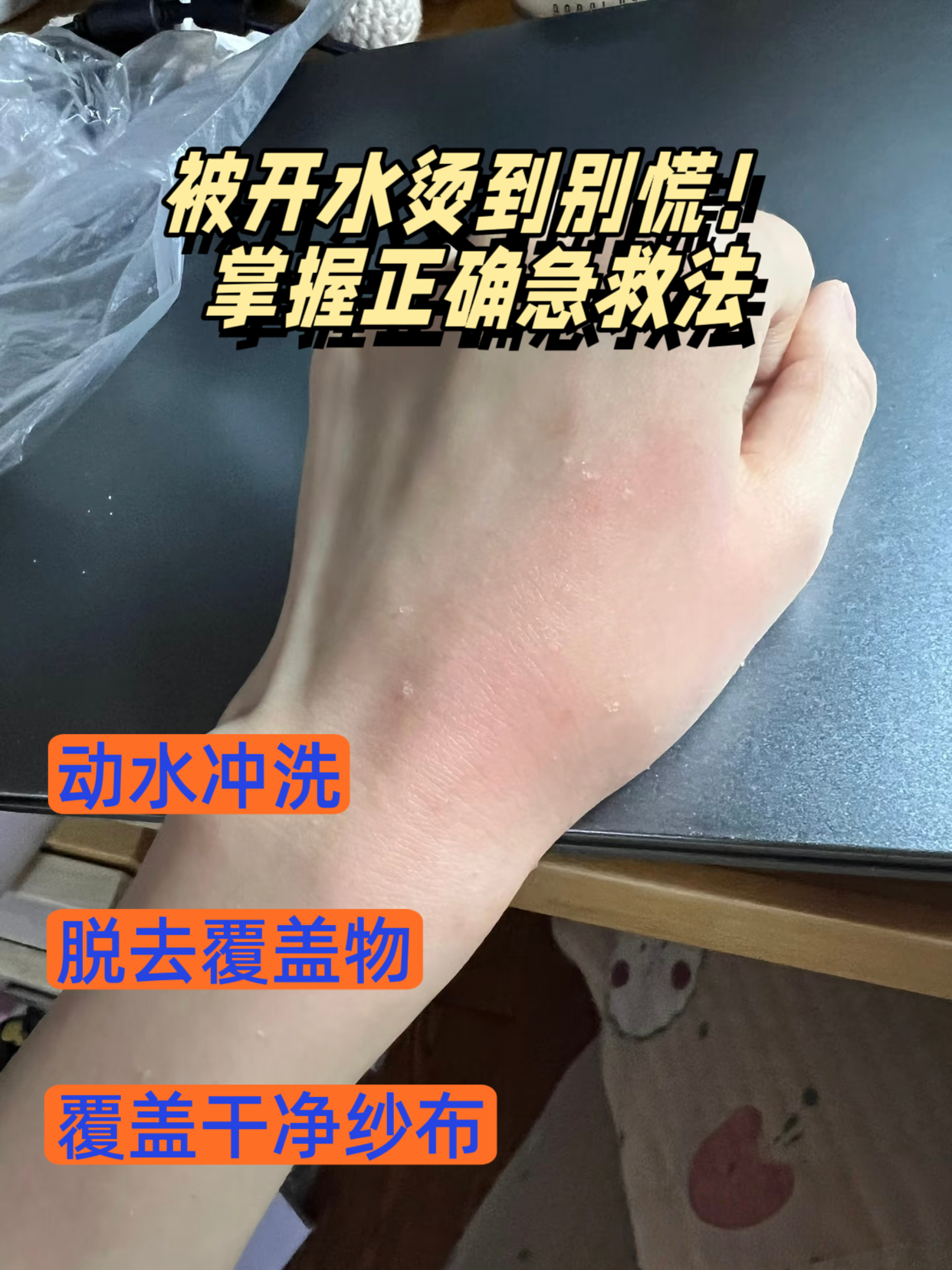 手被烫伤了怎么办