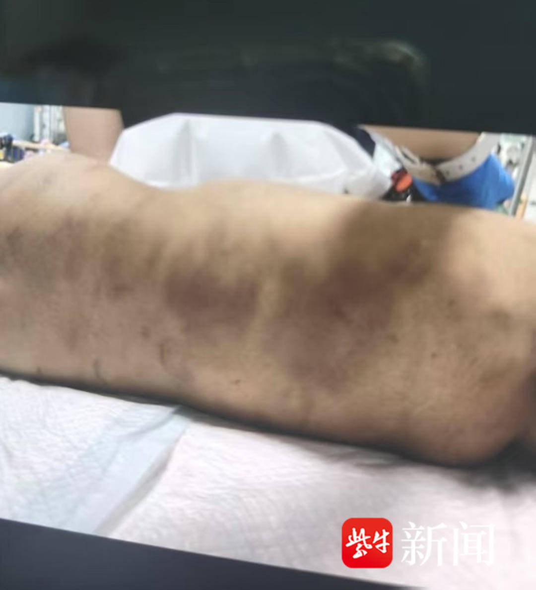 孩子夭折了,是指死了吗?