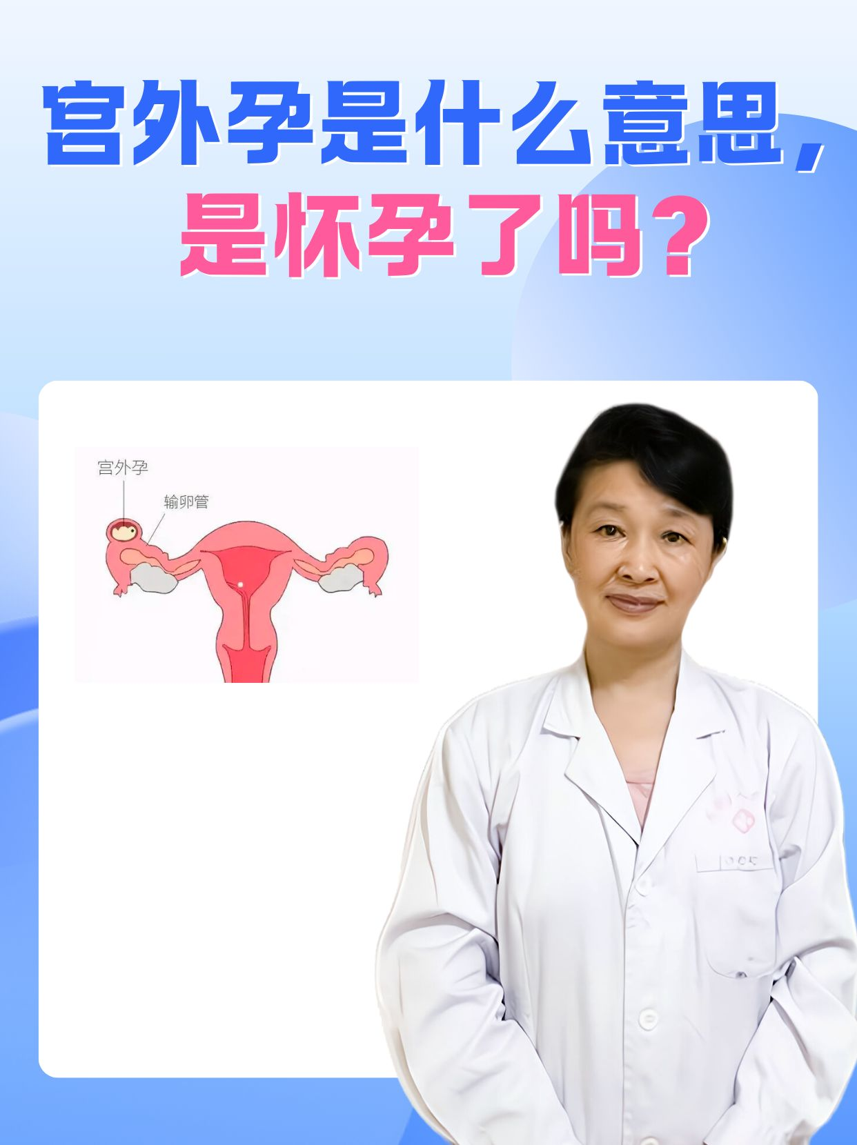 宫外孕是怎么造成的