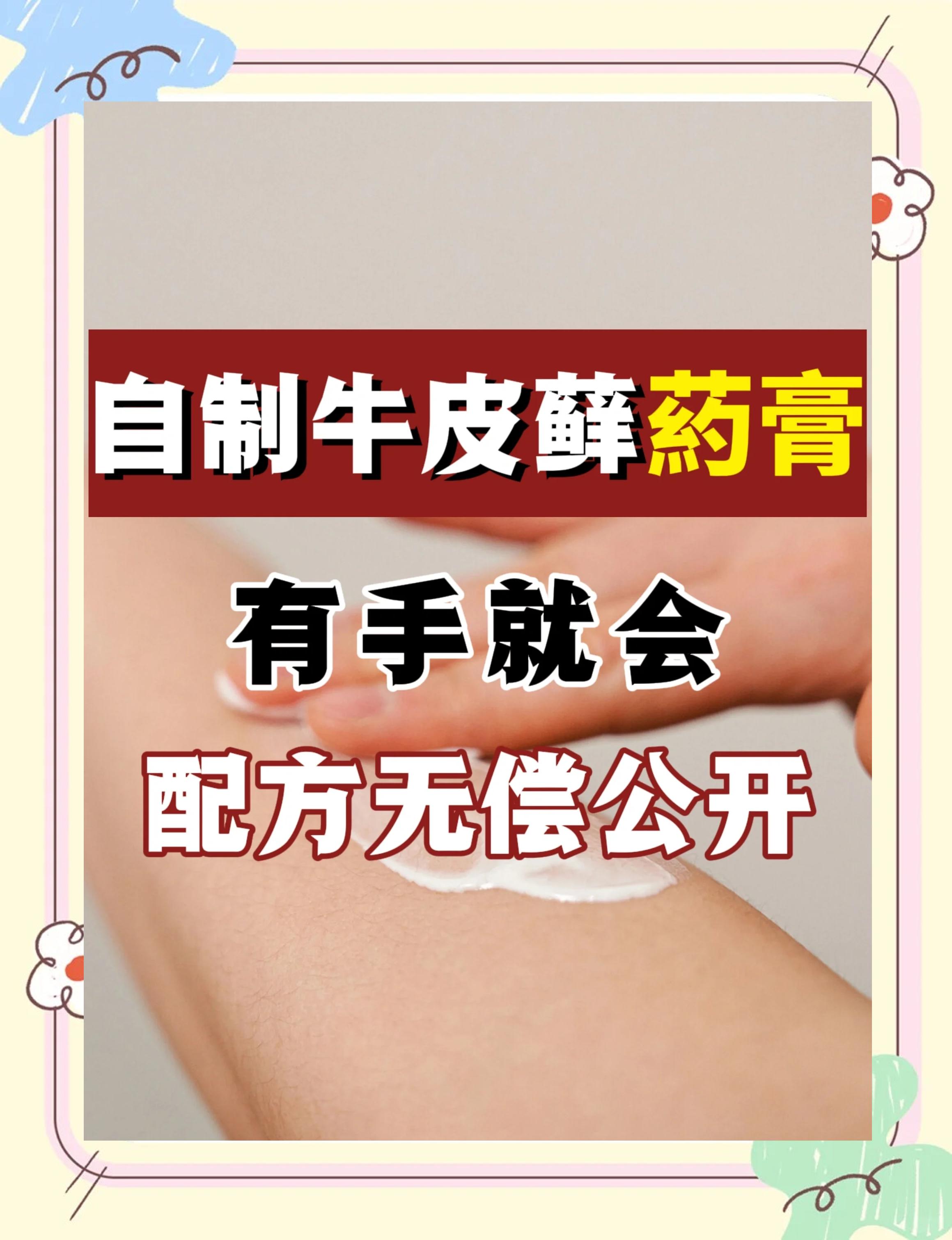 银屑病中药治疗方法