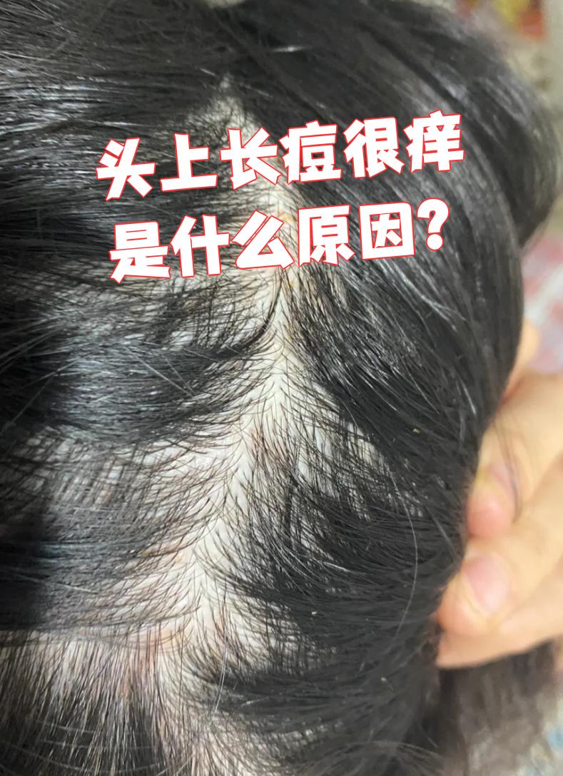 头起疙瘩痒是怎么回事