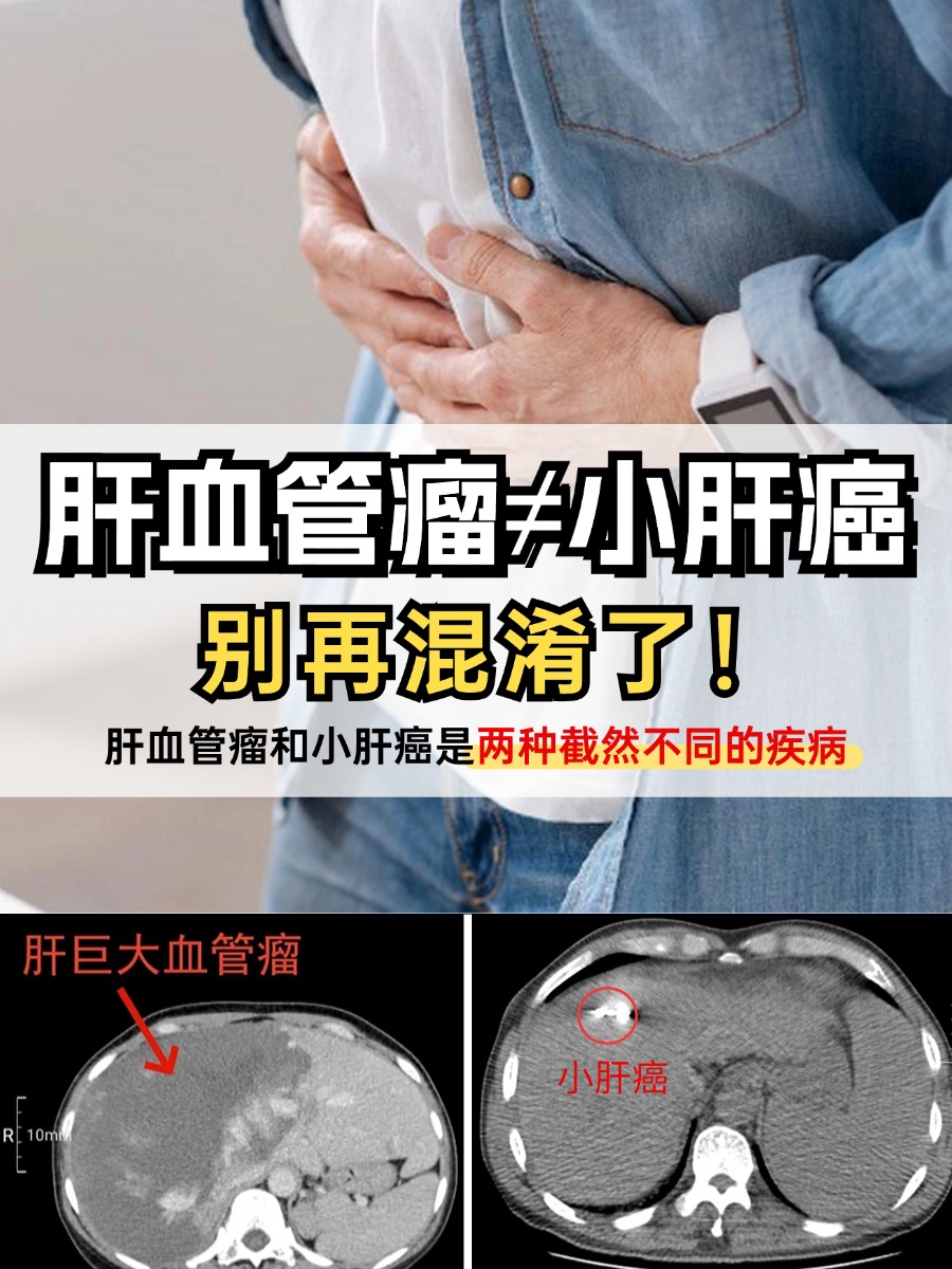 肝血管瘤的症状有哪些