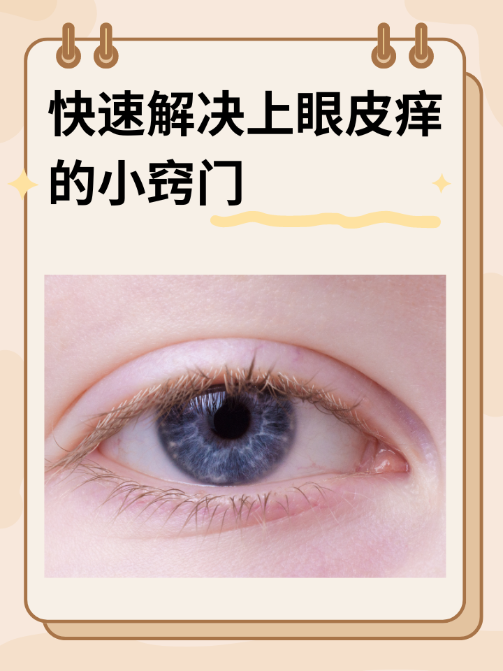 上眼皮痒是怎么回事?