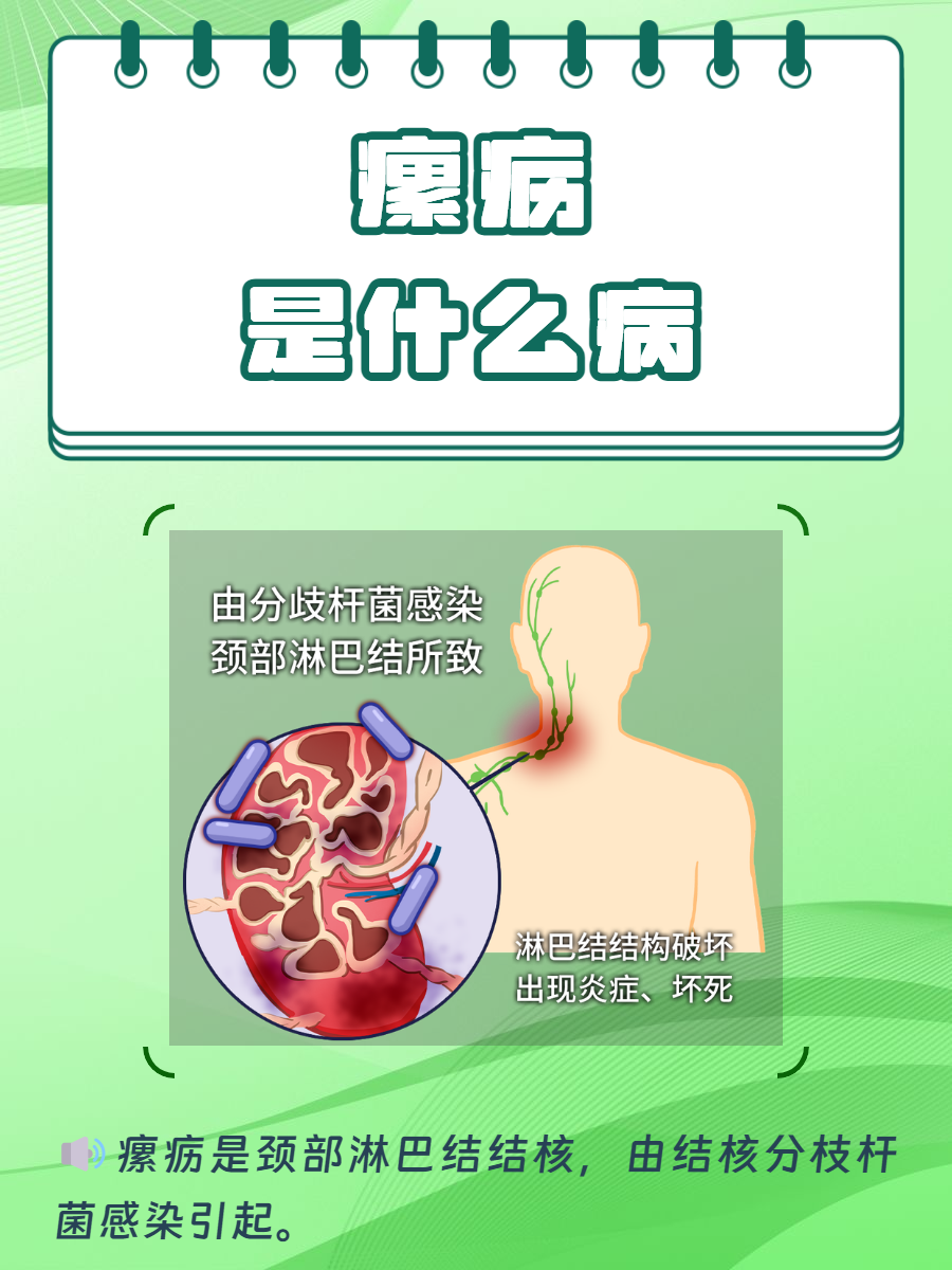 内消瘰疬片主治什么?