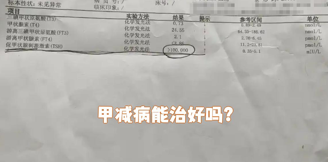 甲减可以治好么