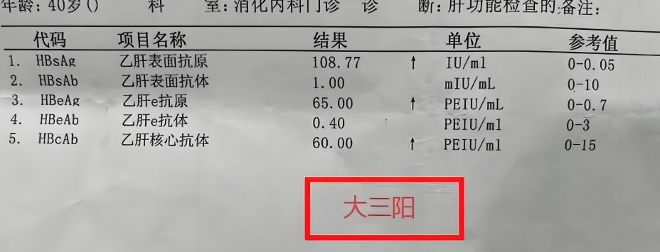 大三阳怎么治疗才快好?