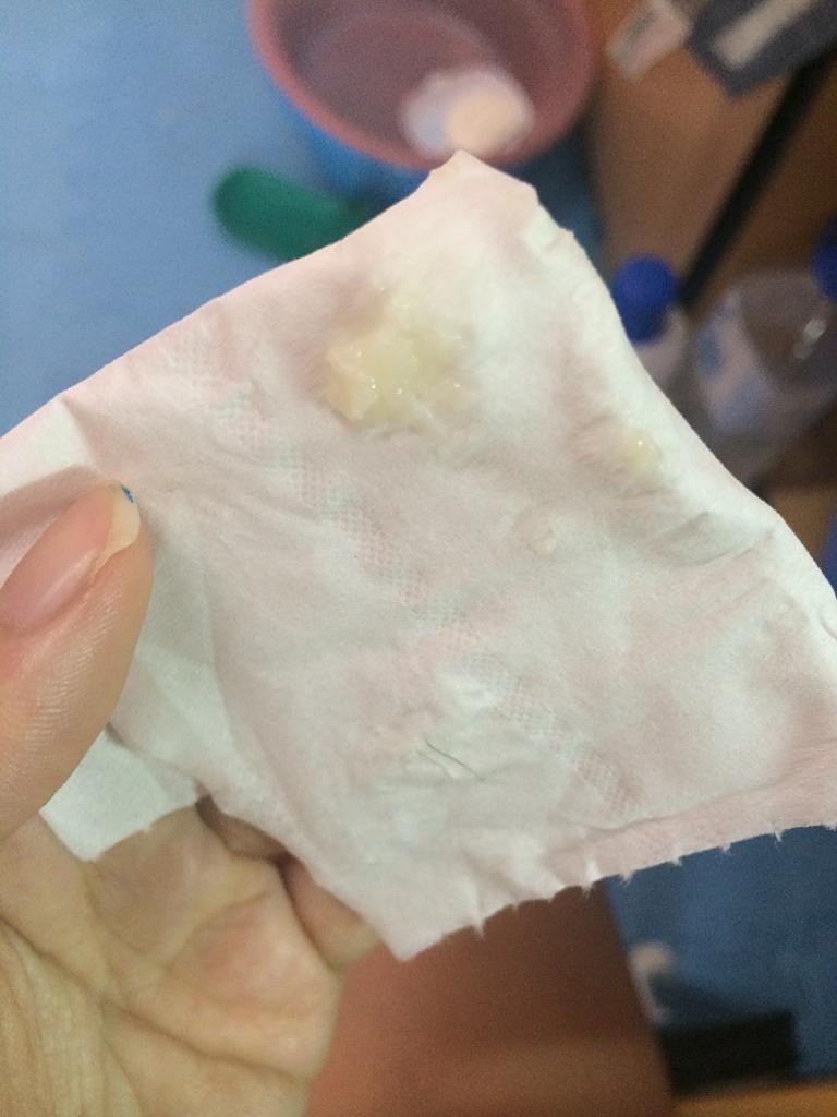 白带是什么样的