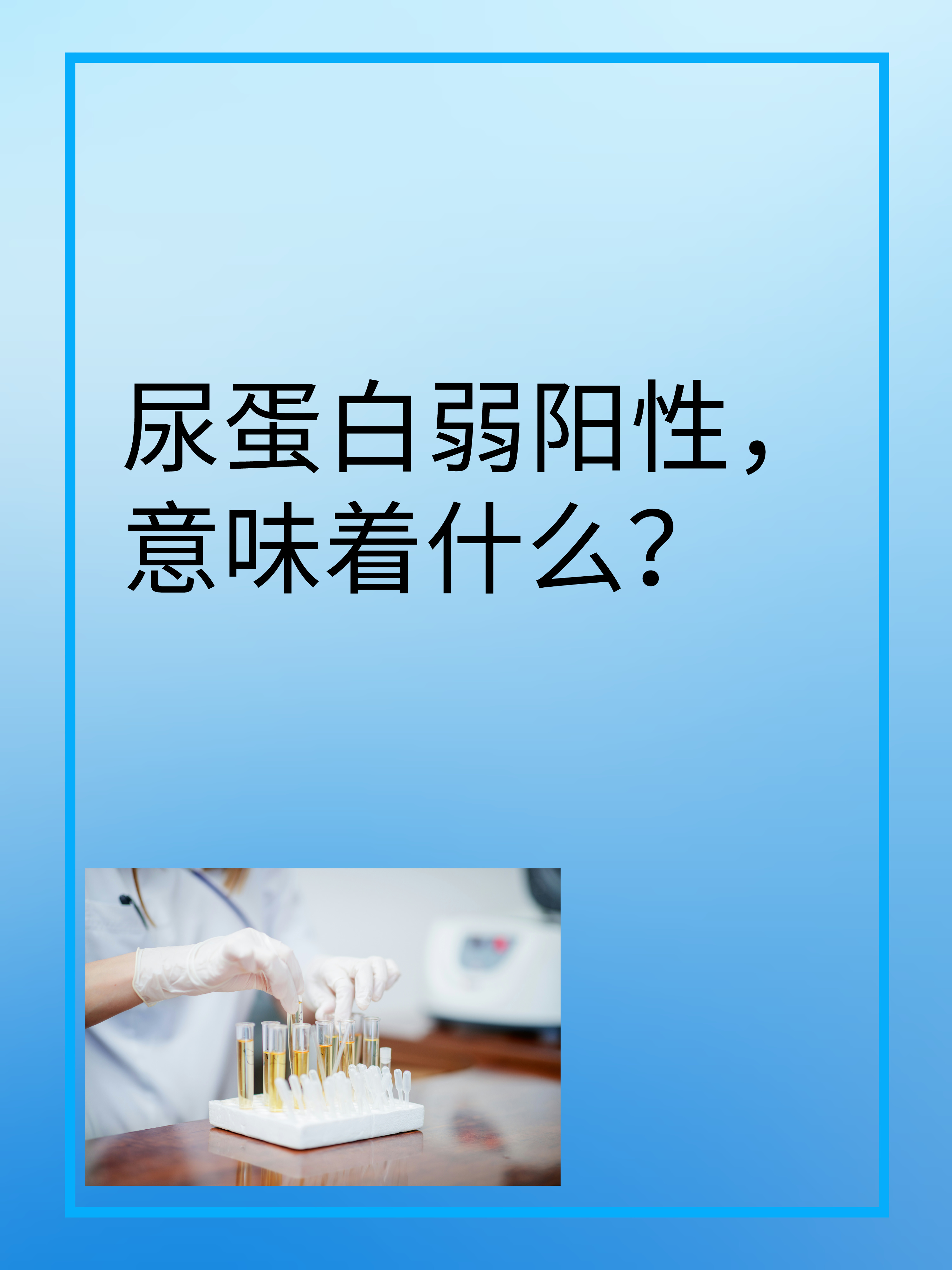 尿蛋白检查出弱阳性严重吗
