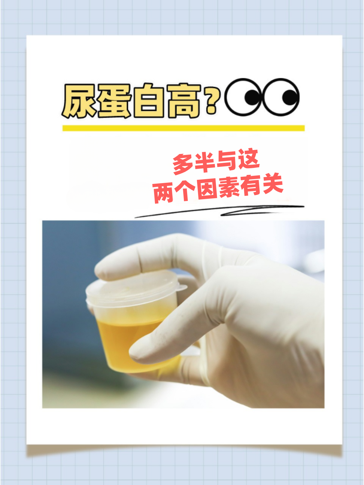 尿蛋白检查出弱阳性严重吗