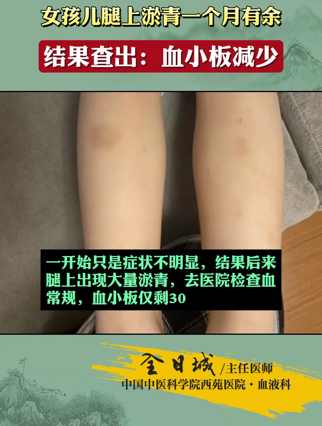 血小板体积偏低会造成什么后果