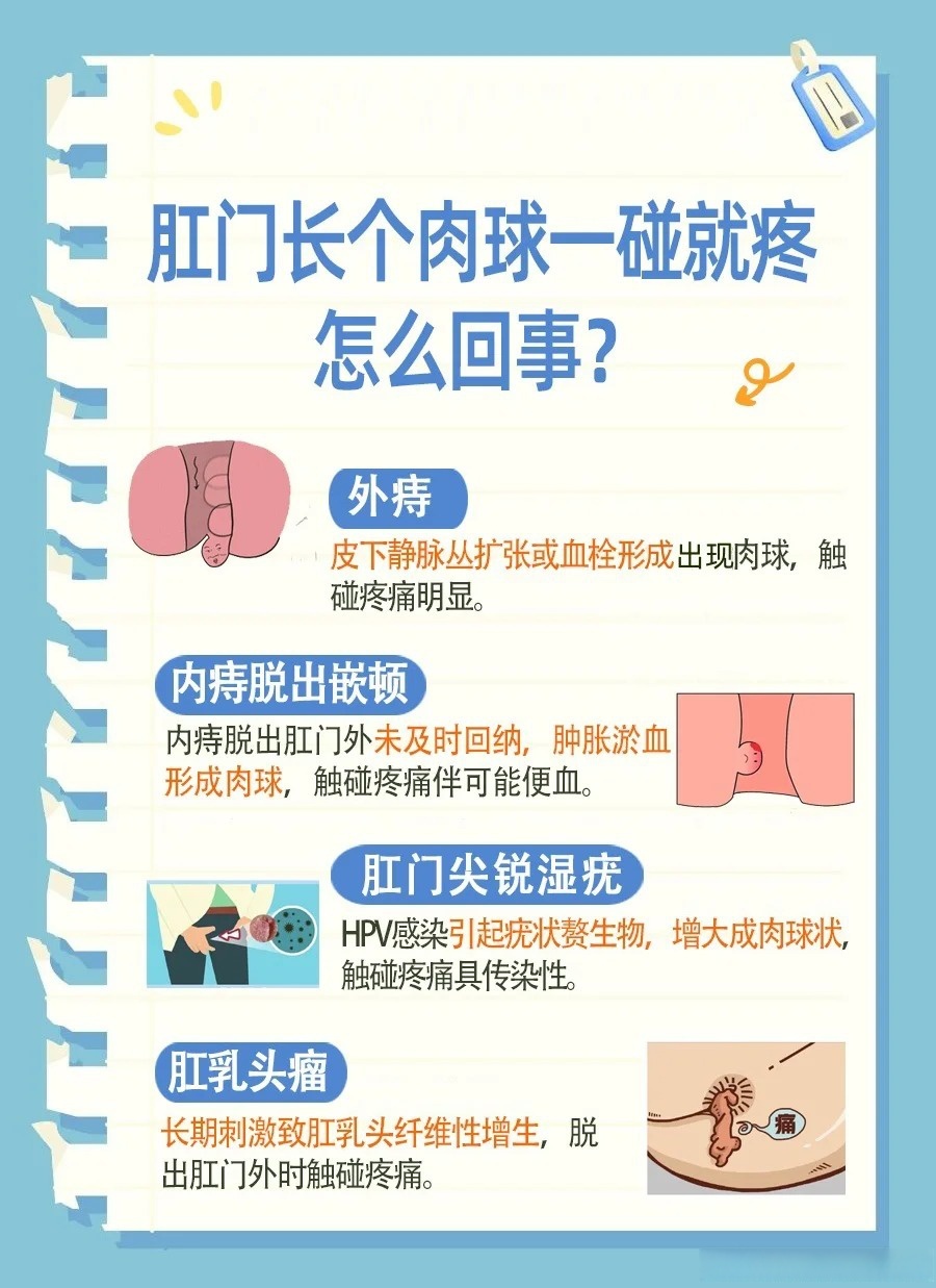 肛门外痔疮
