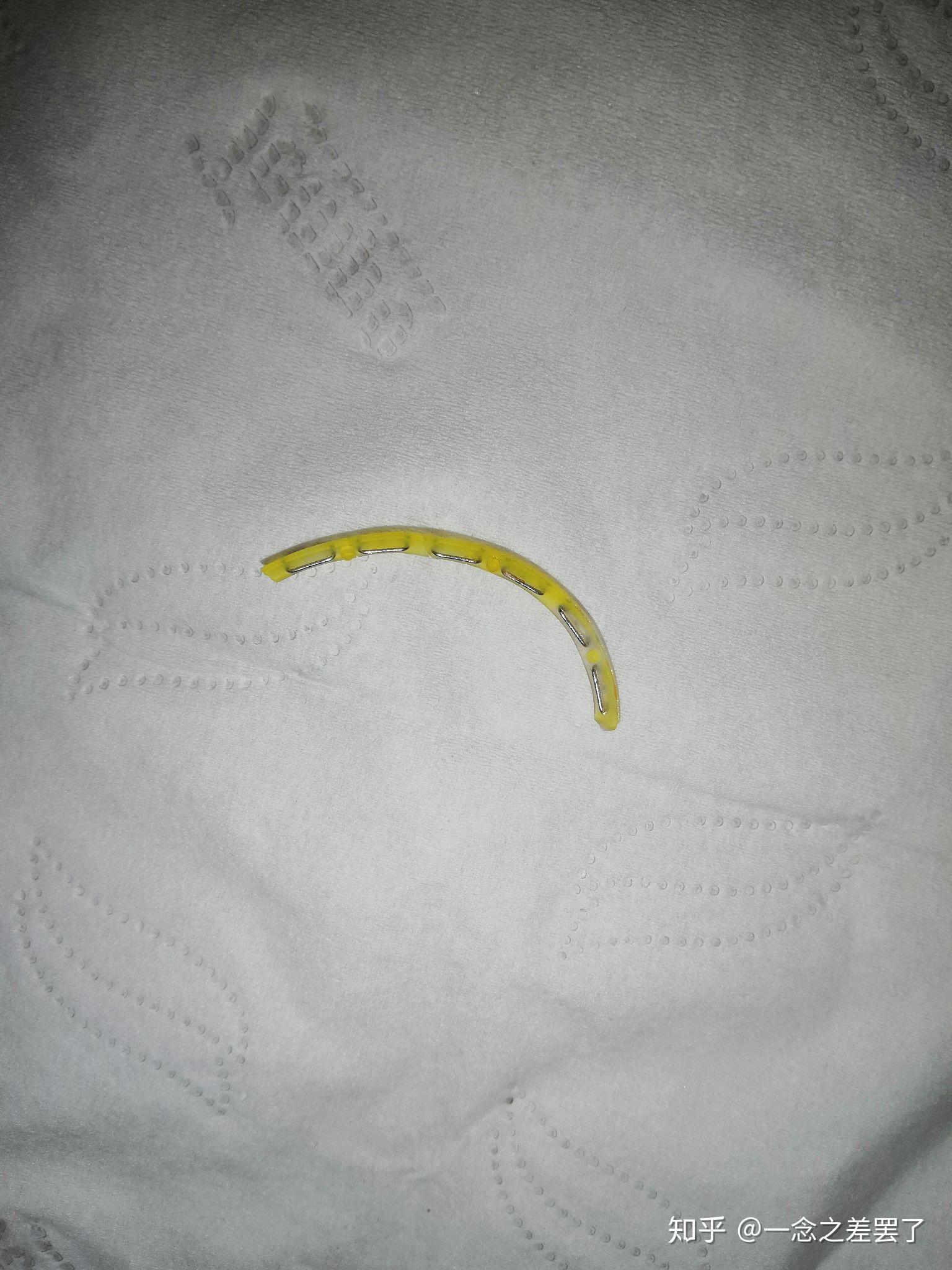 做完包皮手术后的系带