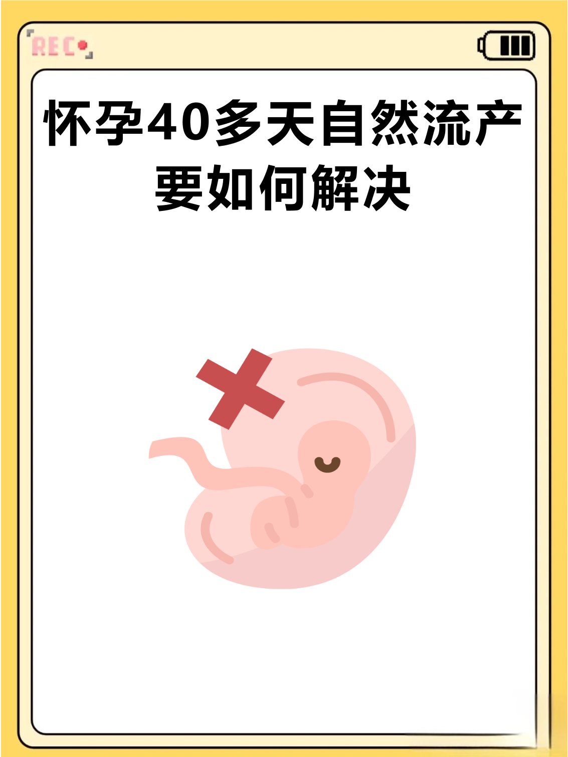 怀孕40天流血应该什么原因