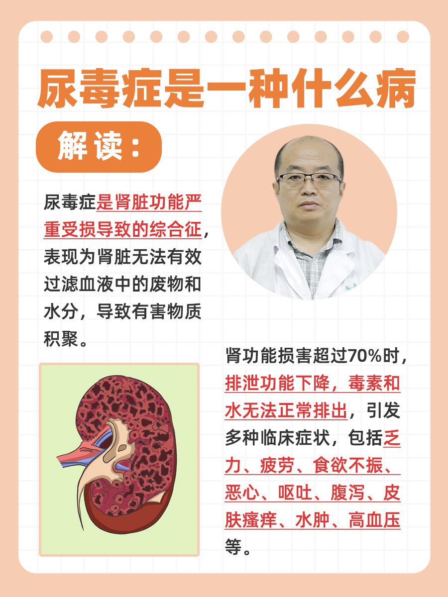 女人尿毒症早期症状