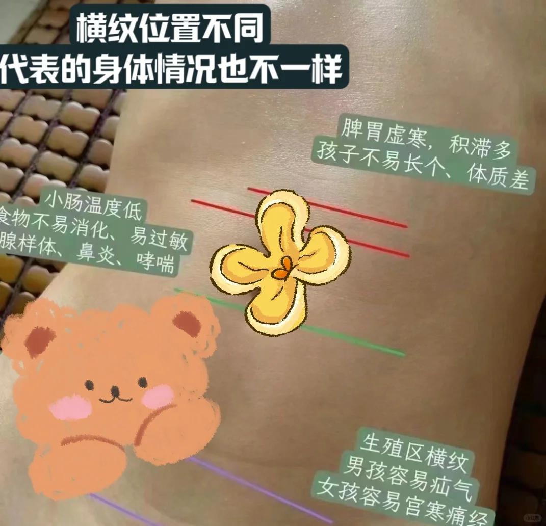 肚子上有一条线是怎么回事