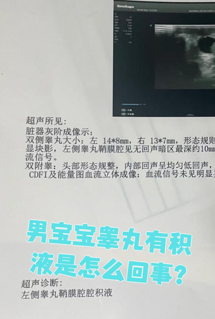 3岁宝宝是鞘膜积液自己还会恢复吗