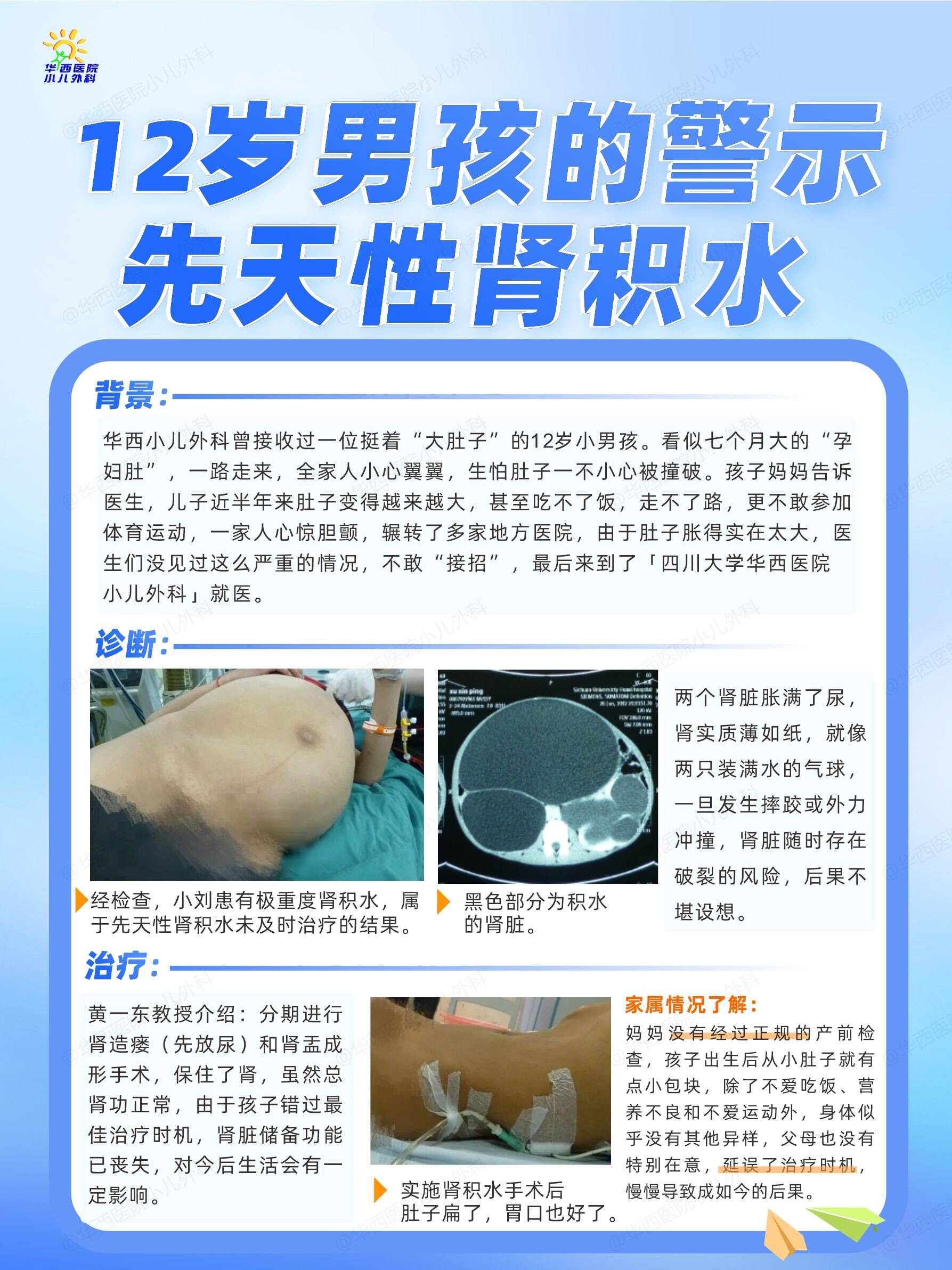 肾积水严重吗?怎么治疗?