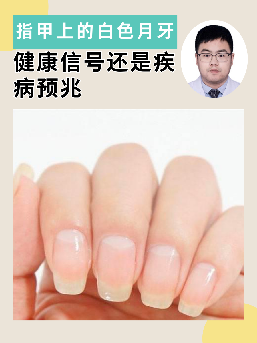 指甲上没有小月牙怎么办?