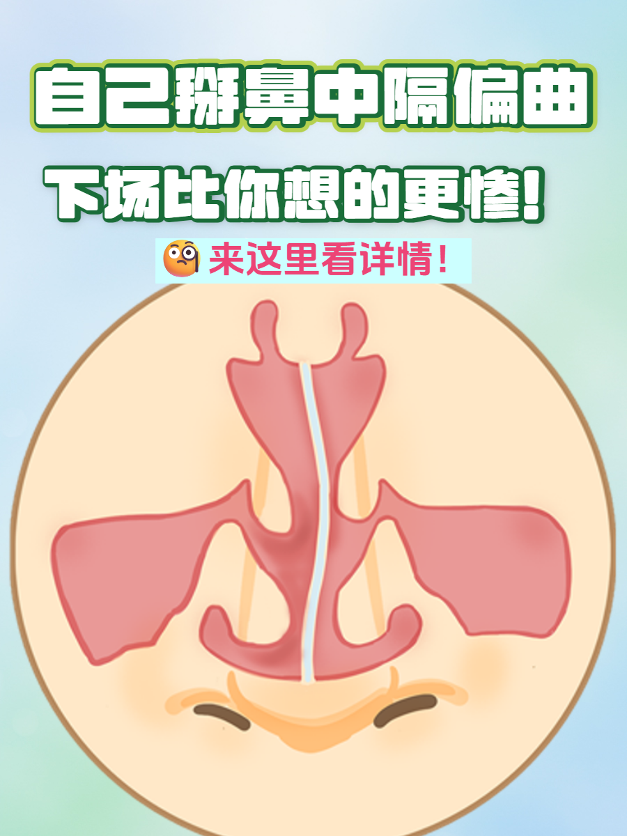 鼻中隔偏曲会癌变吗