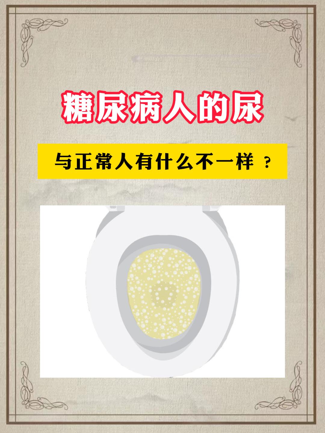 怎样判断泡沫尿是不是蛋白尿?