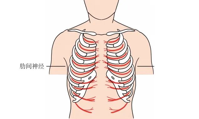 肋间神经痛很严重吗