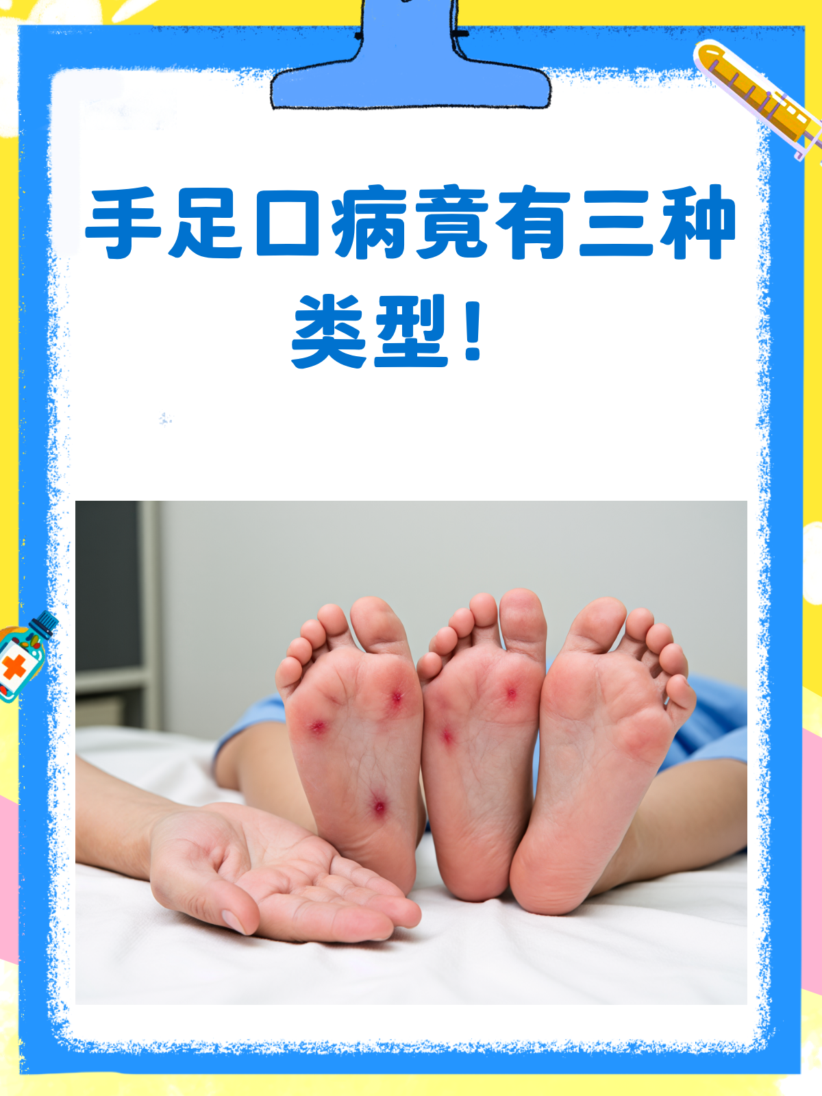 手足口病概念