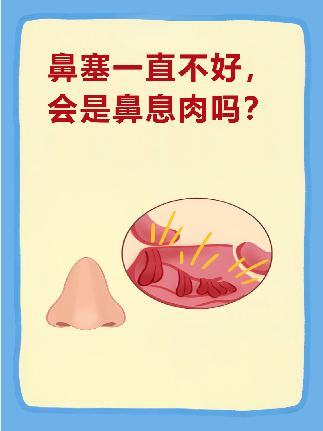 鼻塞的原因是什么?