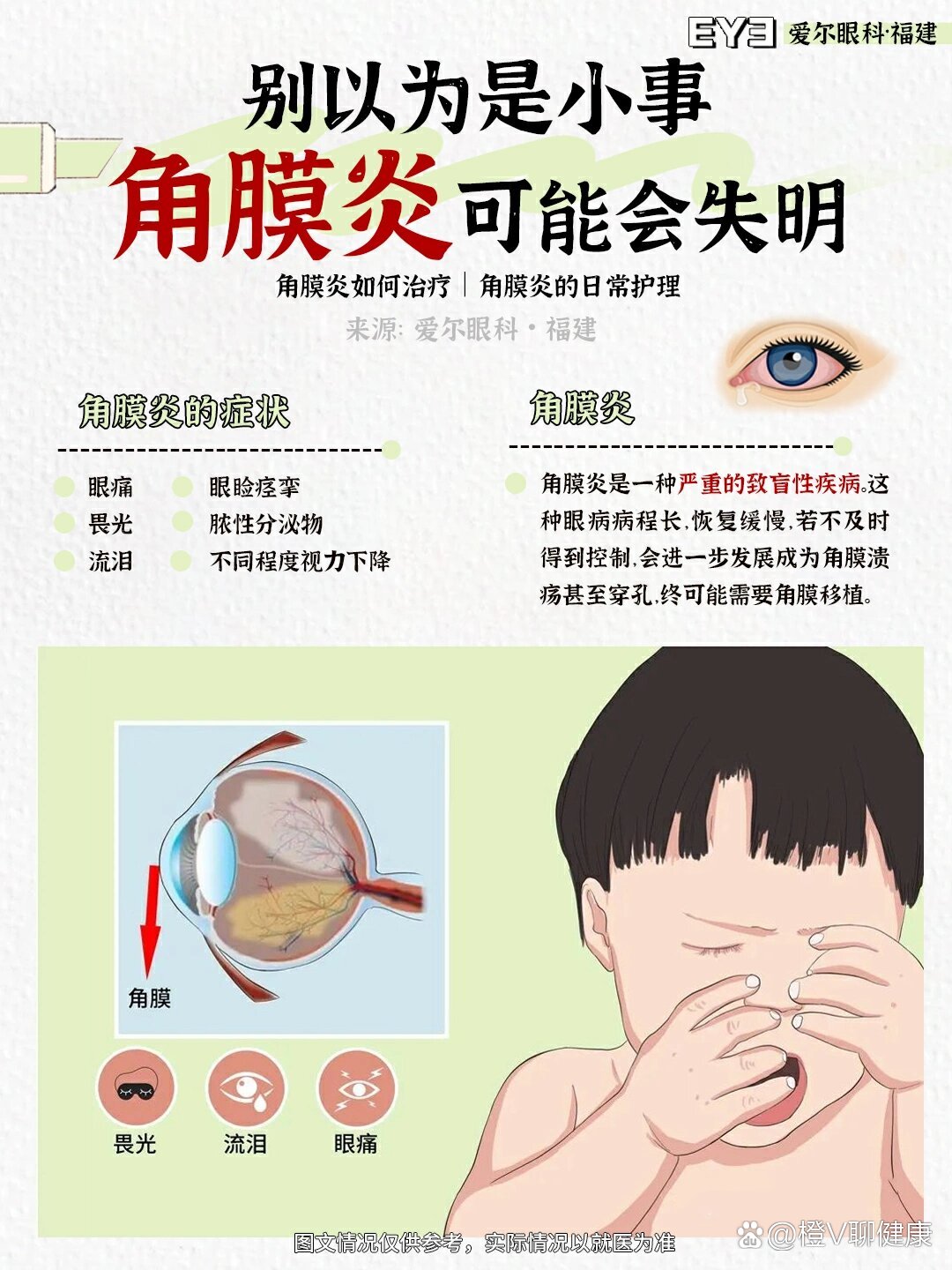 结膜炎与角膜炎的区别