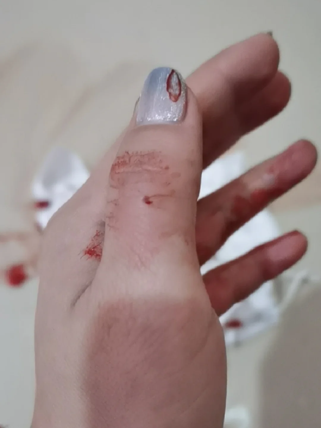 我被我家两个月多的小猫咬了一个比针眼大点小眼