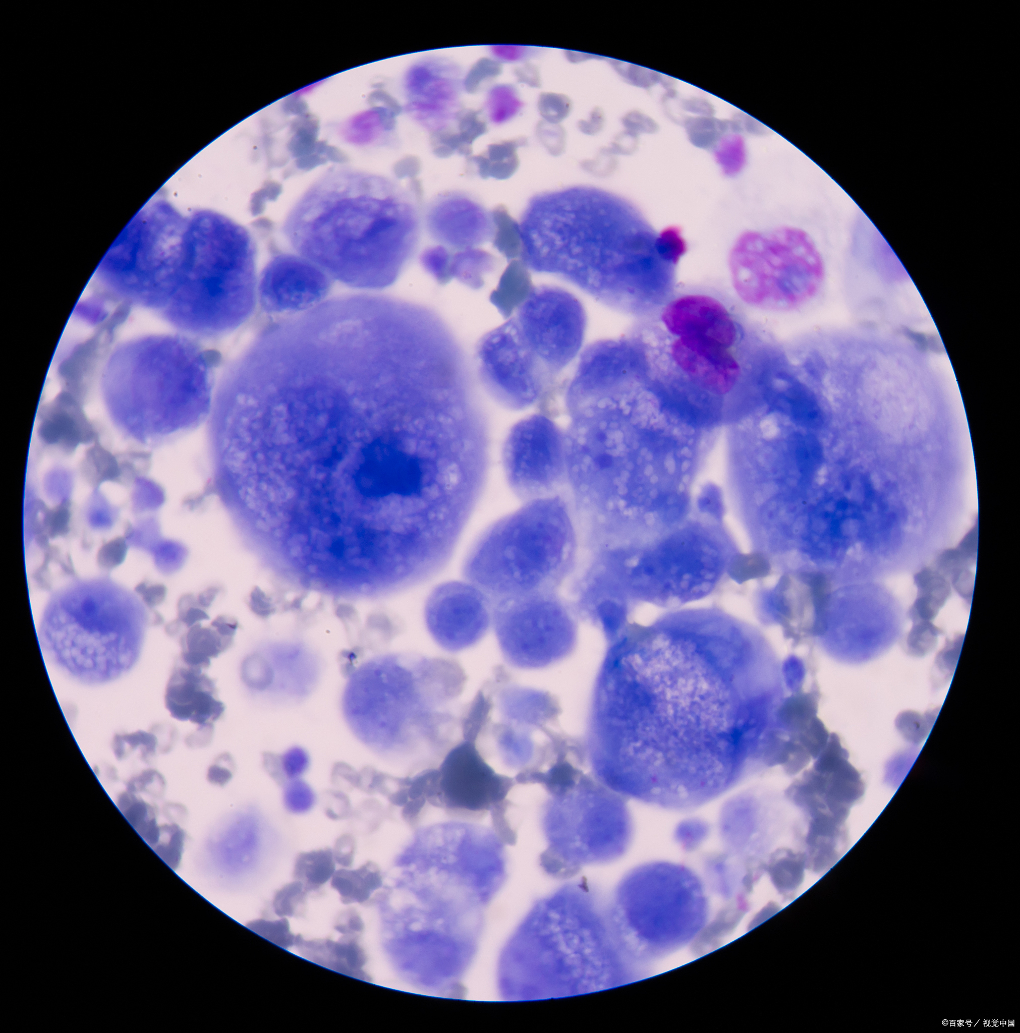 支原体衣原体感染有什么症状