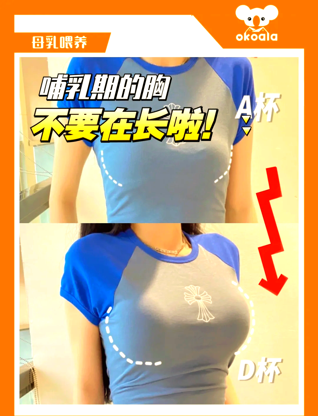 感觉乳房有点大怎么办