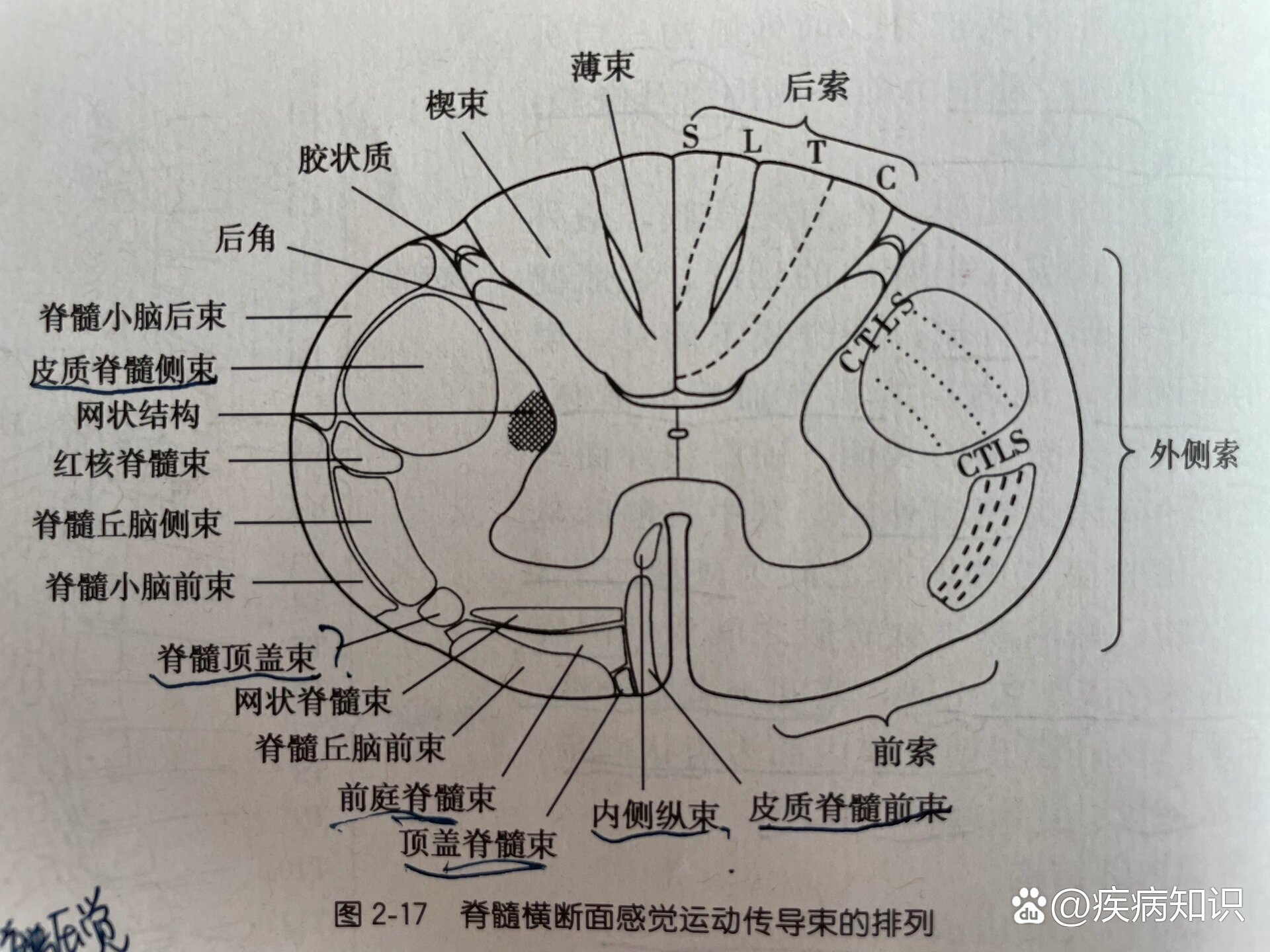 什么是脊髓灰质炎