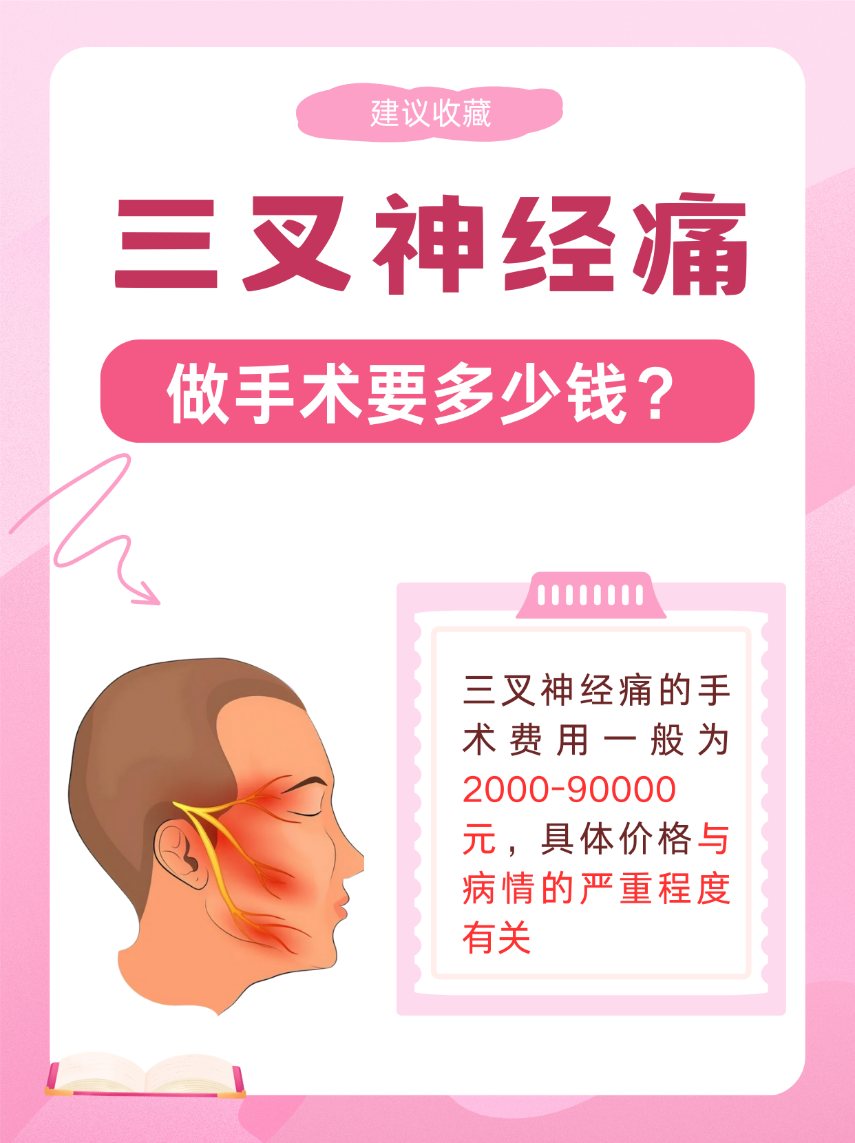 如何根治三叉神经痛