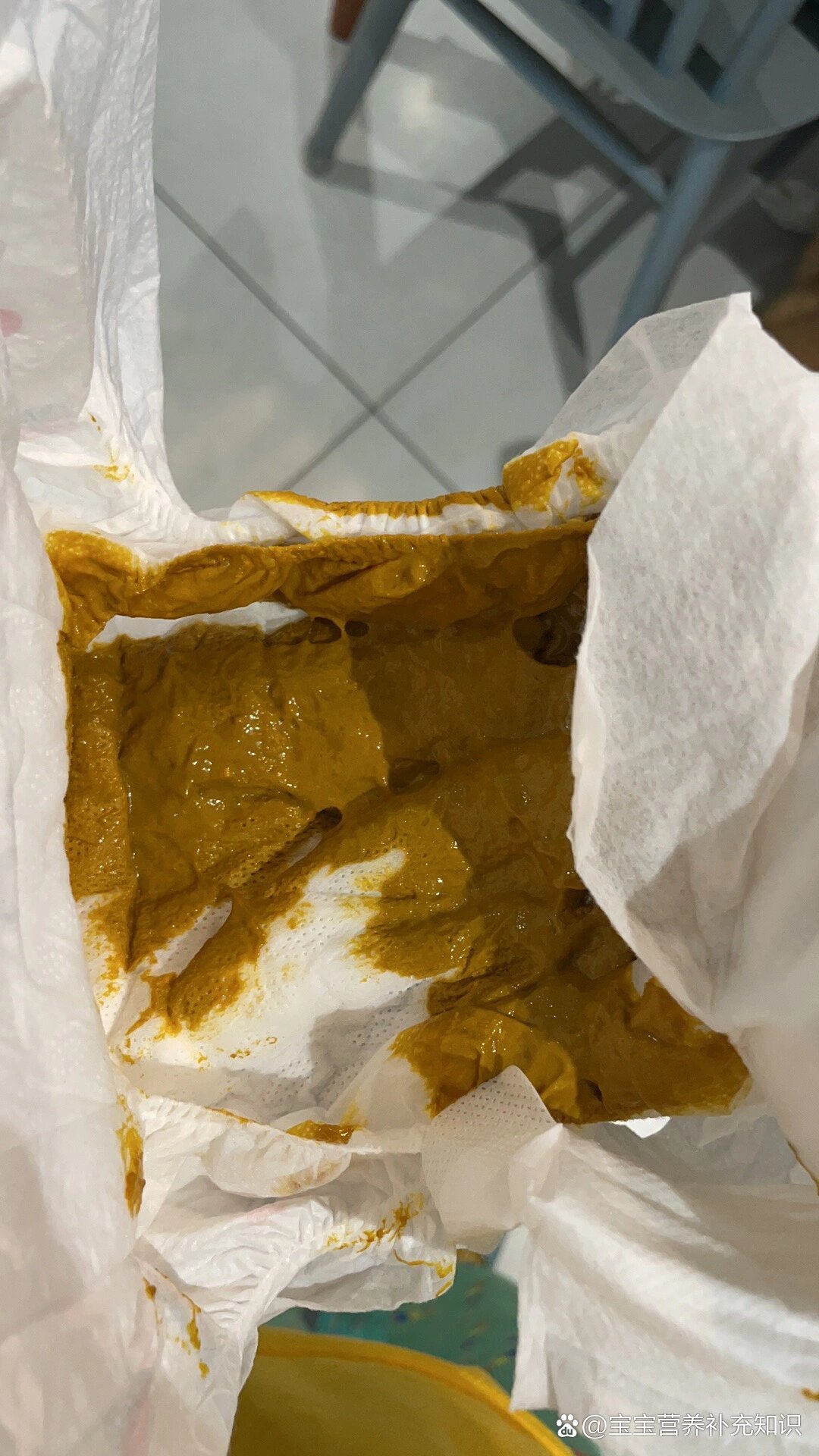 宝宝大便为什么有粘液